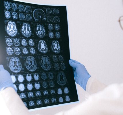 Alzheimer's disease treatment