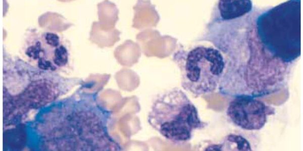community cancer care